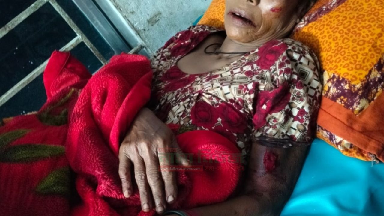 কোটালিপাড়ায় কুড়িয়ে পাওয়া ককটেল বিষ্ফোরনে বৃদ্ধা আহত 