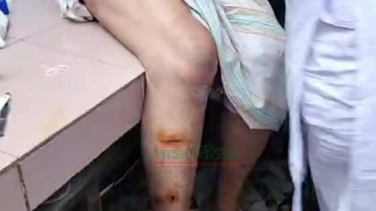 বরগুনায় সাবেক এমপি হিরুর উপর দুর্বৃত্তদের হামলা ‎