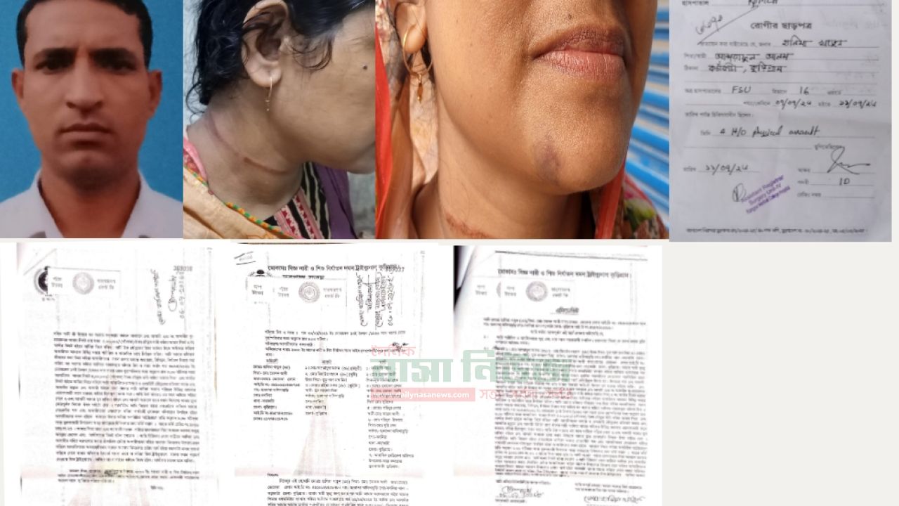 পাঁচ লাখ টাকা যৌতুক চেয়ে মারধর, হত্যার চেষ্টা-পুলিশ সদস্যের বিরুদ্ধে স্ত্রীর মামলা